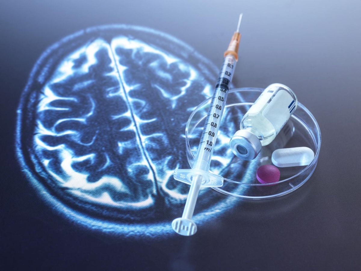 Médecine  Nouveau traitement prometteur contre Alzheimer ?