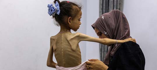  Ghaza / Une famine dévastatrice a coûté la vie à au moins 466 personnes depuis 2024